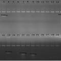 PCR-SSP法檢測29種HLA-B27亞型