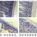 GLP-2保護(hù)應(yīng)激性潰瘍大鼠腸道屏障功能的初步研究