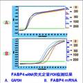 枸杞多糖對THP-1單核細(xì)胞源性巨噬細(xì)胞內(nèi)質(zhì)網(wǎng)應(yīng)激的影響