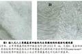 植入式人工角膜基質及其制備方法