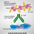 常用化療方案對(duì)原代乳癌細(xì)胞抑制率與基因過表達(dá)的相關(guān)性研究