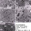 殺蟲(chóng)劑啶蟲(chóng)脒影響雄性小鼠生殖功能的研究