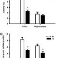 低氧預(yù)適應(yīng)減輕腦中動脈阻塞所致小鼠缺血性腦損傷