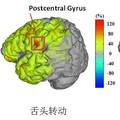 基于顱內(nèi)腦電的高精度腦功能映射與神經(jīng)監(jiān)護(hù)系統(tǒng)