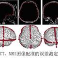 基于顱內(nèi)腦電的高精度腦功能映射與神經(jīng)監(jiān)護系統(tǒng)