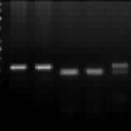 環(huán)氧化酶-2基因多態(tài)性與2型糖尿病的相關(guān)性研究