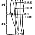 溫針灸減低阿司匹林抗風(fēng)濕劑量引起胃腸道副作用的研發(fā)方案