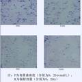 青蒿素對(duì)人宮頸癌HeLa細(xì)胞輻射增敏作用的研究