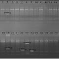 PCR-SSP法檢測29種HLA-B27亞型