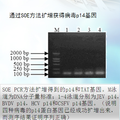 p14多肽——新型黃科病毒解螺旋酶抑制劑的克隆表達(dá)系統(tǒng)構(gòu)建及抗病毒研究